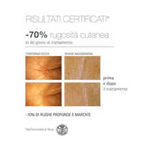 Carica l'immagine nel visualizzatore di Gallery, Siero Riparatore Rughe Profonde | Line Control C5